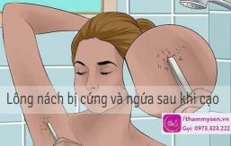 Lông nách bị cứng và ngứa hơn sau khi cạo