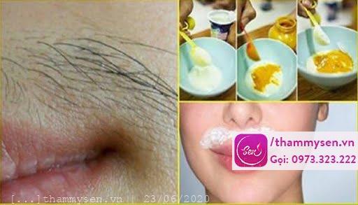 Làm mờ ria mép bằng bột mì bột nghệ và sữa tươi