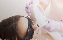 Triệt ria mép có hết hay không?