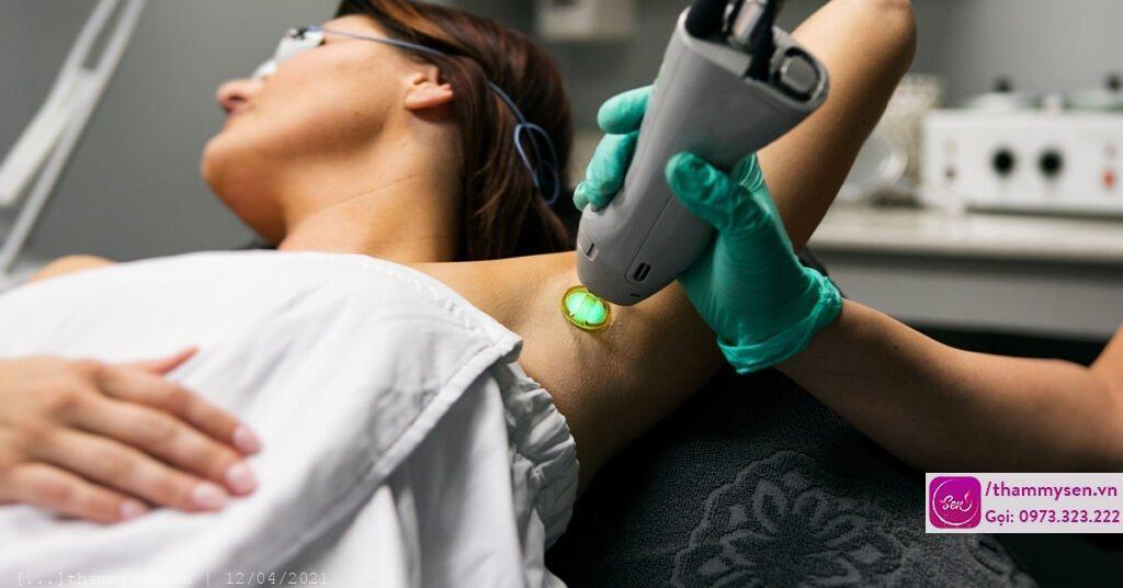 Trị hôi nách vĩnh viễn hiệu quả với Plasma PTD